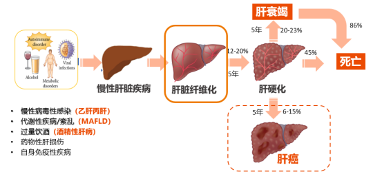 FibroScan ® 全球独有核心专利技术，聚焦肝脏疾病诊断