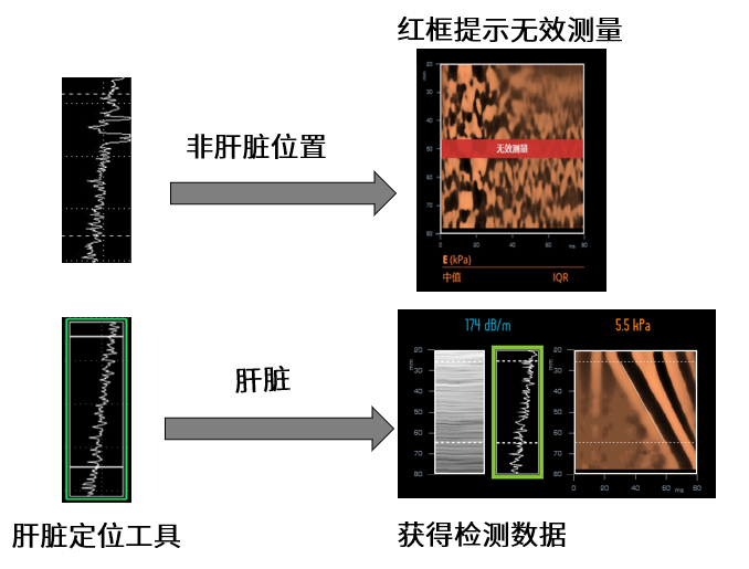 看见新力量|国产FibroScan® Pro无创肝病检测仪成医疗健康新热门