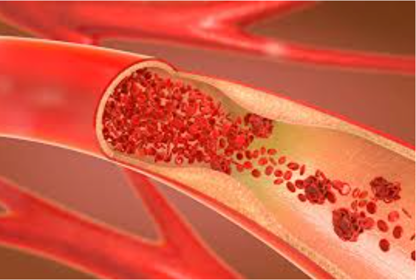 2025降血压血脂产品选购清单！想要有效降血压血脂效果好且靠谱的品牌？水蛭素降三高十大品牌深度测评！