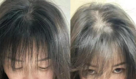 去屑洗发水哪个牌子效果最好？哪款性价比最好还安全？2026实测十款公认去屑止痒好用的洗发水推荐，去屑止痒洗发水第一名