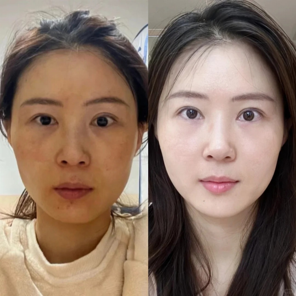 10d2cab52196a009b7fc9718fd383bcedbfc98c0b109e36bf1cfd62722c84f95